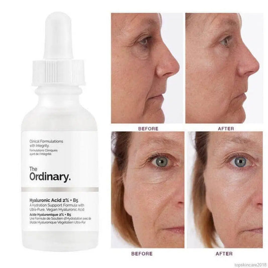 The Ordinary Hyaluronic Acid Hydrating Face Serum, 30 Ml